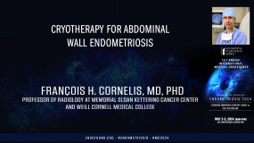 Cryotherapy for Abdominal Wall Endometriosis - François Cornelis, MD?
