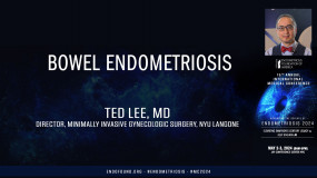 Bowel  Endometriosis - Ted Lee, MD?