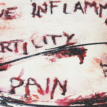 These Fearless Women ShowWhat Endometriosis Really Looks Like